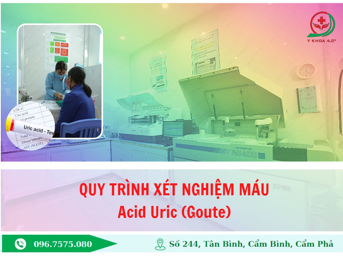 Quy trình và chi phí xét nghiệm Acid Uric (Goute)