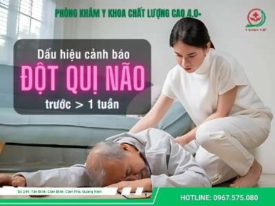 Dấu hiệu cảnh báo đột quỵ trước 1 tuần, 30 ngày đến vài tháng
