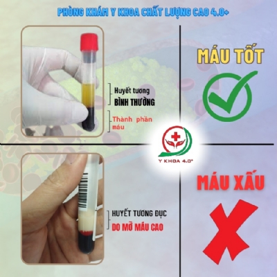 Lý do tại sao nên xét nghiệm mỡ máu định kỳ