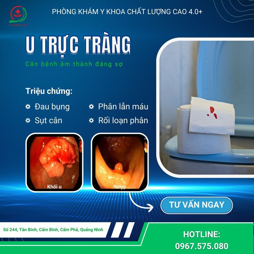 Gầy sút cân kèm đi ngoài ra máu: Dấu hiệu cảnh báo ung thư trực tràng bạn không thể bỏ qua